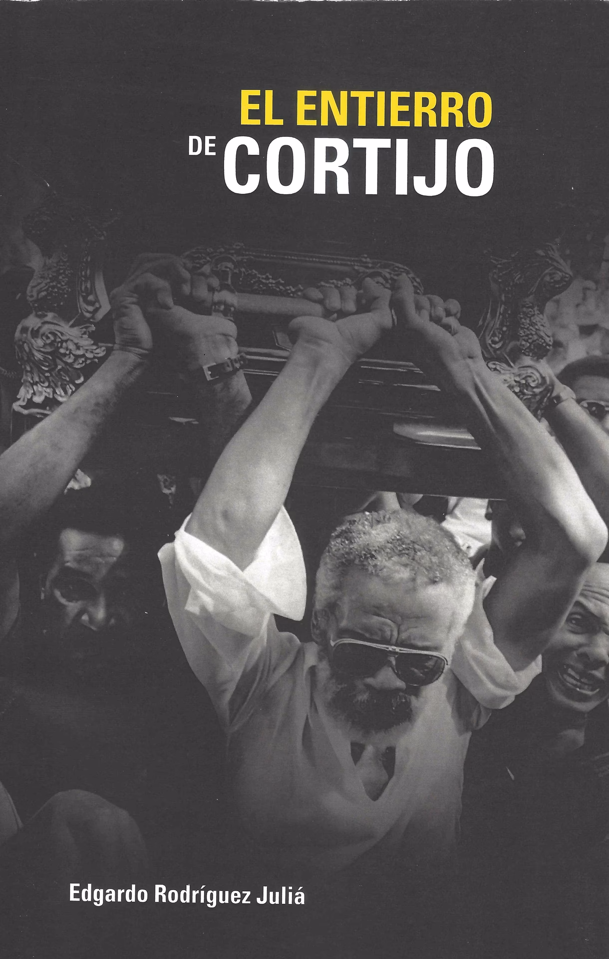 ¿Quién nació con polidactilia en la mano izquierda?